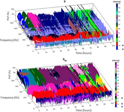 Interictal localization of the epileptogenic zone: Utilizing the observed resonance behavior in the spectral band of surrounding inhibition